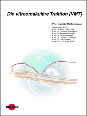 cover image of Die vitreomakuläre Traktion (VMT)